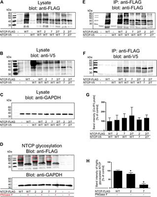 Mutational Analysis of the GXXXG/A Motifs in the Human Na+/Taurocholate Co-Transporting Polypeptide NTCP on Its Bile Acid Transport Function and Hepatitis B/D Virus Receptor Function